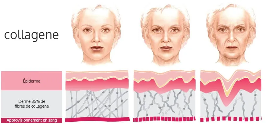 image avec trois visages de femme et les effets du collagene sur l'epiderme image avec trois visages de femme et les effets du collagene sur l'epiderme