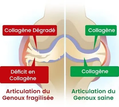 image presentant la difference entre une articulation ayant du collagene degradé et une autre avec du collagene normal image presentant la difference entre une articulation ayant du collagene degradé et une autre avec du collagene normal